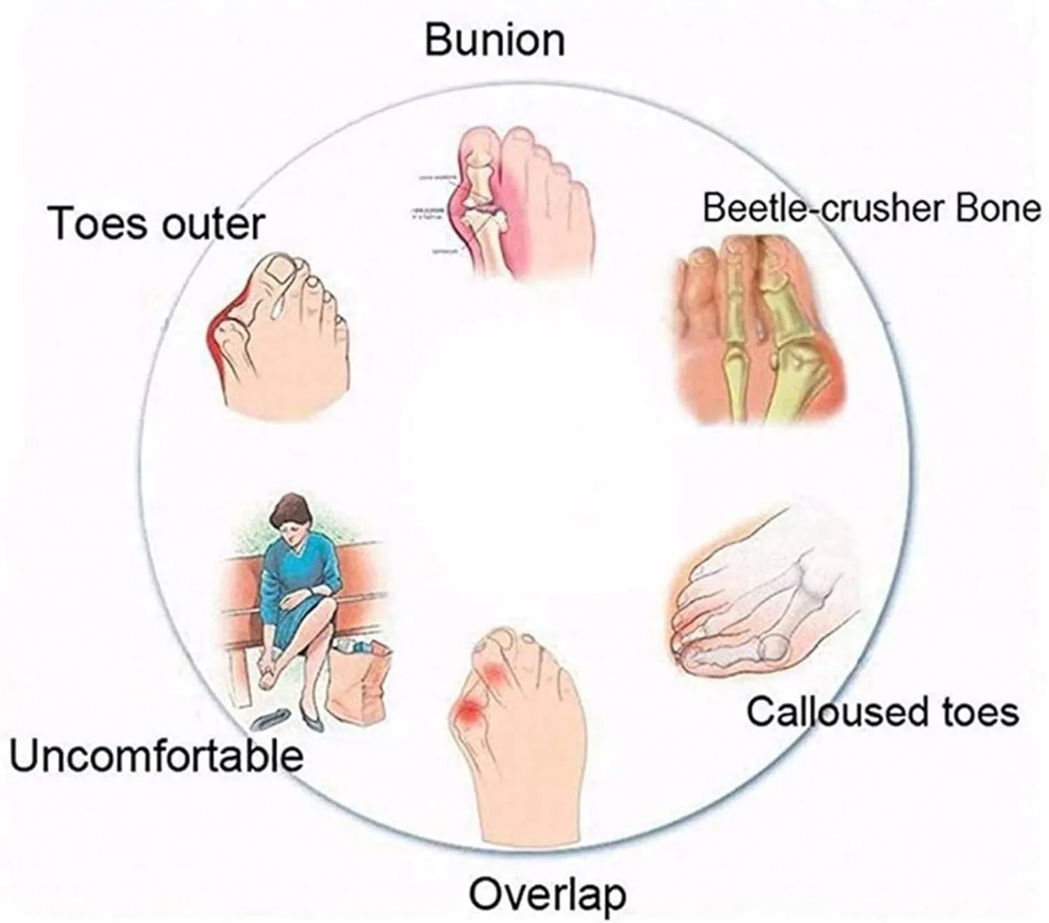 Non-Slip Bunion Corrector Sandals Men, Soft Cushion Walking Men's Sandals Bunion Relief